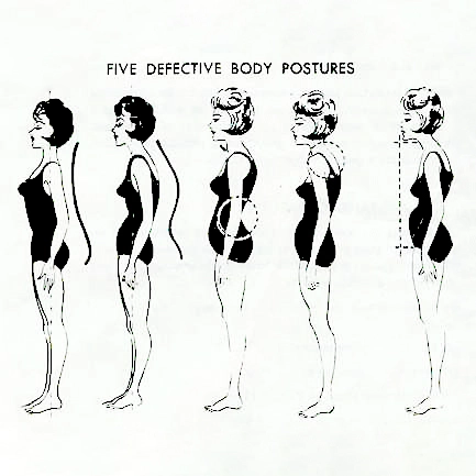 Diagram illustrating five defective body postures in women, showcasing varied curved spine positions from side view.